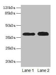CTSL Antibody