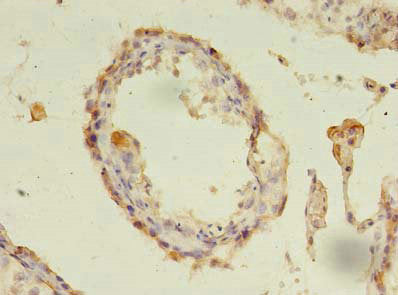 CXADR Antibody