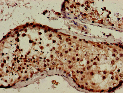 CXorf1 Antibody