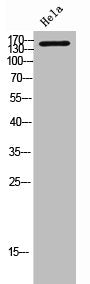 MST1R Antibody