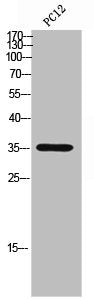 ATP1B3 Antibody