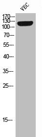 Phospho-TEK (Y992) Antibody