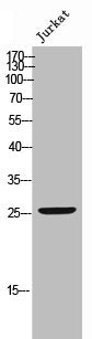 Phospho-BCL2 (S70) Antibody