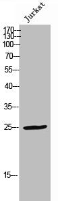 Phospho-FADD (S191) Antibody