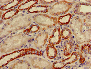 CYP11B2 Antibody