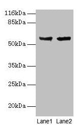 CYP17A1 Antibody
