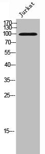 CDH17 Antibody