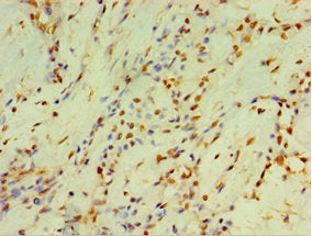 CYP2J2 Antibody