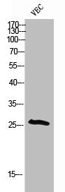 Phospho-CDKN1B (T198) Antibody