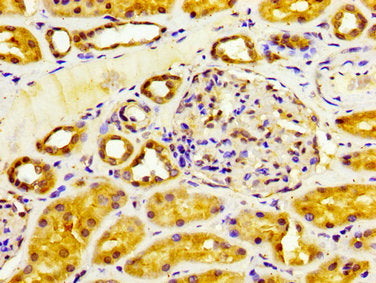 CYP4F2 Antibody