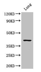 CYSLTR1 Antibody