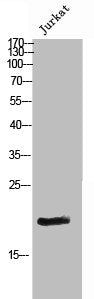 Phospho-CDKN2A (S326) Antibody