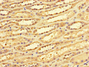 DACH1 Antibody