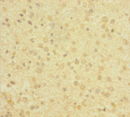 DBI Antibody