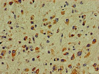DCLK1 Antibody