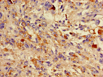 DCT Antibody