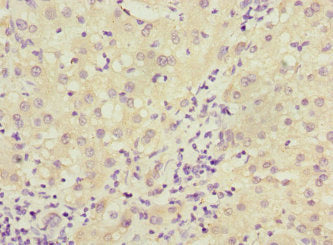 DCTD Antibody