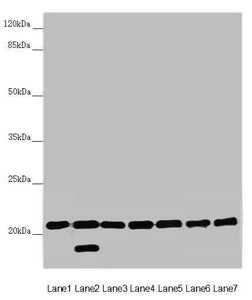 DCTN6 Antibody