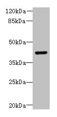 DCX Antibody