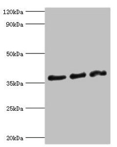 DFFA Antibody