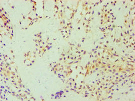 GSDME Antibody