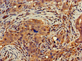 DGAT1 Antibody