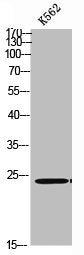 Phospho-TIRAP (Y86) Antibody
