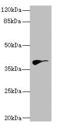 DHDDS Antibody