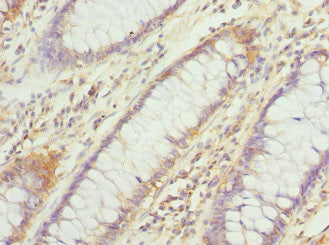 DHDDS Antibody