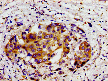 DHODH Antibody