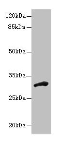 DHRS12 Antibody
