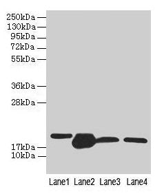 DHRS3 Antibody
