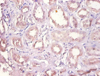 DHRS9 Antibody