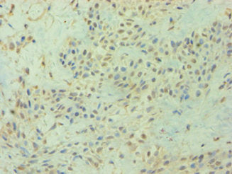DIRAS3 Antibody