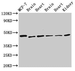 DKC1 Antibody