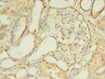 DLEU1 Antibody