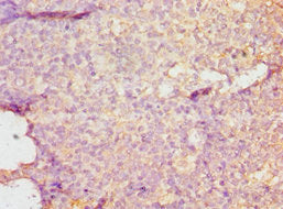 DMP1 Antibody