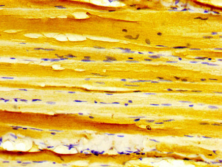 DMPK Antibody