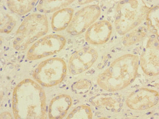 DNA2 Antibody