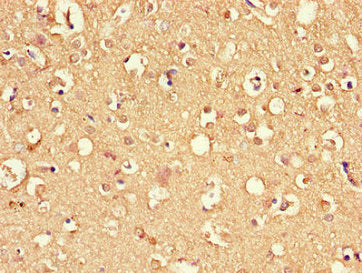 DNAJC6 Antibody