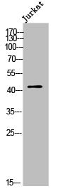 OR2AJ1 Antibody