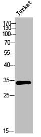 OR6P1 Antibody