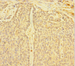 DNTTIP1 Antibody