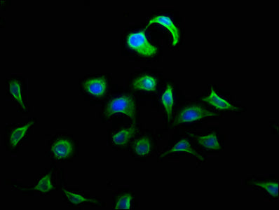 DOK5 Antibody