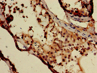 DXO Antibody