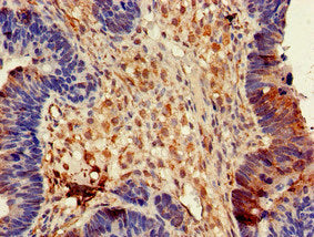 DPYSL4 Antibody