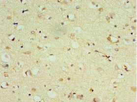 DRD3 Antibody
