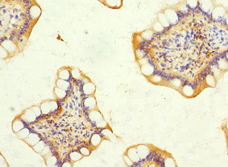 DSC2 Antibody