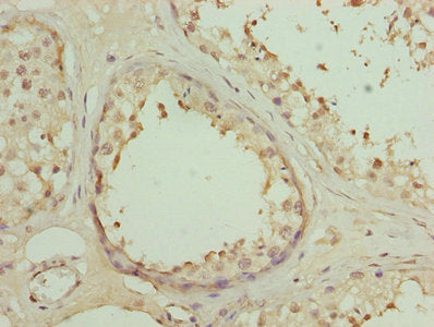 DSCR9 Antibody