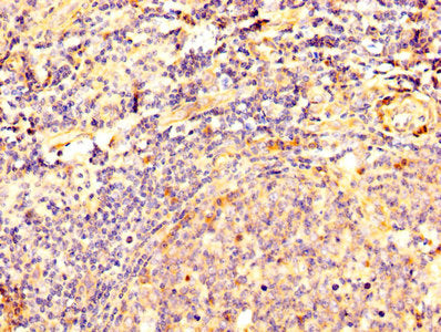 DSG3 Antibody